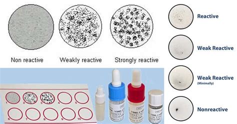 vdrl test non reactive|VDRL Test: Principle, Procedure, Results • Microbe .